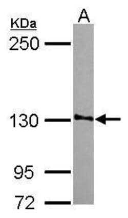 Invitrogen SMG7 Polyclonal Antibody 100 &mu;L; Unconjugated:Antibodies,