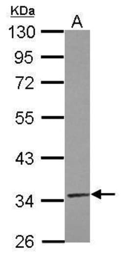 Invitrogen TRUB2 Polyclonal Antibody 100 &mu;L; Unconjugated:Antibodies,
