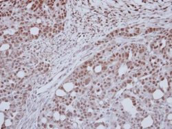 Invitrogen ZNF417 Polyclonal Antibody 100 &mu;L | Buy Online | Invitrogen&trade; | Fisher Scientific