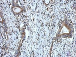 Invitrogen DUS2L Polyclonal Antibody 100 &mu;L; Unconjugated:Antibodies,