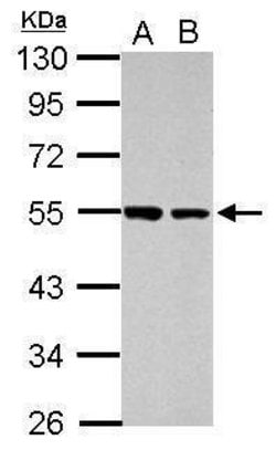 Invitrogen DUS2L Polyclonal Antibody 100 &mu;L; Unconjugated:Antibodies,