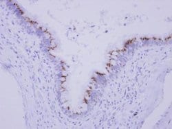Invitrogen CGI-62 Polyclonal Antibody 100 &mu;L; Unconjugated:Antibodies,