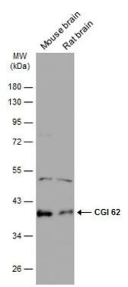 Invitrogen CGI-62 Polyclonal Antibody 100 &mu;L; Unconjugated:Antibodies,