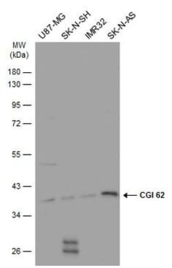 Invitrogen CGI-62 Polyclonal Antibody 100 &mu;L; Unconjugated:Antibodies,