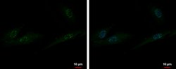 ZXDA Polyclonal Antibody, Invitrogen 100 μL; Unconjugated:Antibodies,