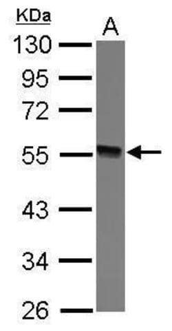 Invitrogen GTDC1 Polyclonal Antibody 100 &mu;L; Unconjugated:Antibodies,