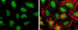 Invitrogen TET3 Polyclonal Antibody 100 &mu;L; Unconjugated:Antibodies,