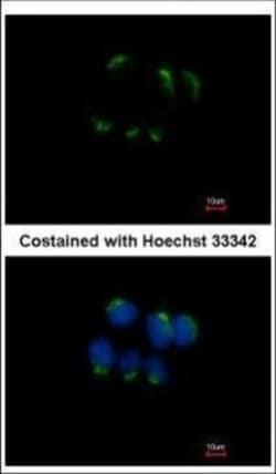 Invitrogen TFF1 Polyclonal Antibody 100 &mu;L | Buy Online | Invitrogen&trade; | Fisher Scientific