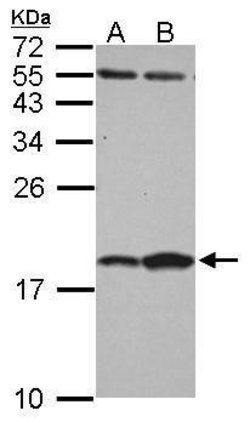 Invitrogen FABP7 Polyclonal Antibody 100 &mu;L; Unconjugated:Antibodies,