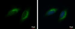 Invitrogen™ COMMD10 Polyclonal Antibody