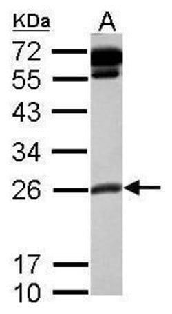 Invitrogen&trade;&nbsp;COMMD10 Polyclonal Antibody