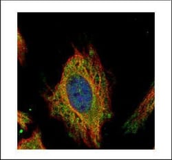 Invitrogen FEM1C Polyclonal Antibody 100 μL; Unconjugated:Antibodies,