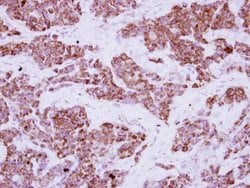 Invitrogen LRRC23 Polyclonal Antibody 100 &mu;L | Buy Online | Invitrogen&trade; | Fisher Scientific