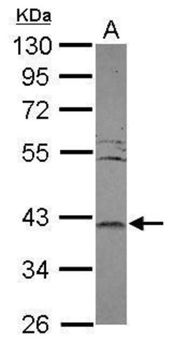 Invitrogen LRRC23 Polyclonal Antibody 100 &mu;L | Buy Online | Invitrogen&trade; | Fisher Scientific