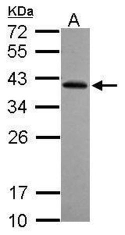 Invitrogen RFPL2 Polyclonal Antibody 100 &mu;L; Unconjugated:Antibodies,