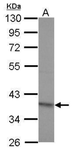 Invitrogen RG9MTD2 Polyclonal Antibody 100 &mu;L; Unconjugated:Antibodies,