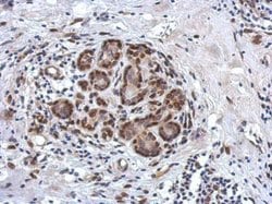 Invitrogen ZBTB20 Polyclonal Antibody 100 &mu;L; Unconjugated:Antibodies,