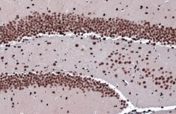Invitrogen ZBTB20 Polyclonal Antibody 100 &mu;L; Unconjugated:Antibodies,