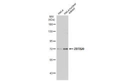 Invitrogen ZBTB20 Polyclonal Antibody 100 &mu;L; Unconjugated:Antibodies,
