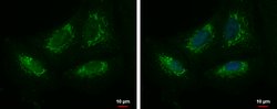 Invitrogen KIAA0391 Polyclonal Antibody 100 &mu;L; Unconjugated:Antibodies,