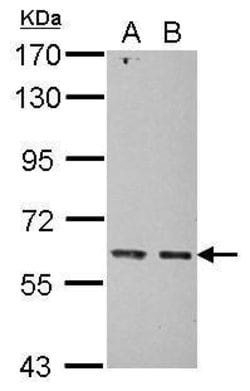 Invitrogen KIAA0391 Polyclonal Antibody 100 &mu;L; Unconjugated:Antibodies,