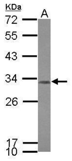 Invitrogen CCDC44 Polyclonal Antibody 100 &mu;L; Unconjugated:Antibodies,