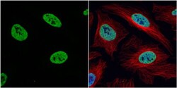 Invitrogen H3K4me2 Polyclonal Antibody 100 &mu;L; Unconjugated:Antibodies,