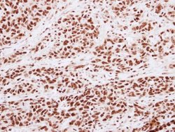 Invitrogen H3K4me2 Polyclonal Antibody 100 &mu;L; Unconjugated:Antibodies,