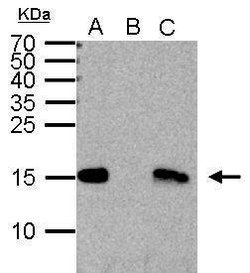 Invitrogen H3K4me2 Polyclonal Antibody 100 &mu;L; Unconjugated:Antibodies,