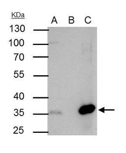 Invitrogen NFYB Polyclonal Antibody 100 &mu;L; Unconjugated:Antibodies,