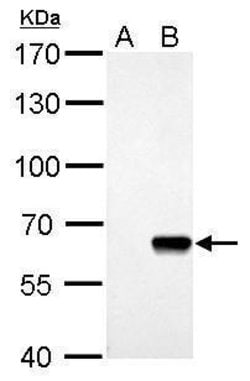 Invitrogen AKT Pan Polyclonal Antibody 100 &mu;L; Unconjugated:Antibodies,