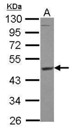 Invitrogen MEK1/MEK2 Polyclonal Antibody 100 &mu;L | Buy Online | Invitrogen&trade; | Fisher Scientific