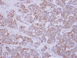 Invitrogen GTDC1 Polyclonal Antibody 100 &mu;L; Unconjugated:Antibodies,
