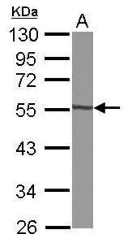 Invitrogen GTDC1 Polyclonal Antibody 100 &mu;L; Unconjugated:Antibodies,