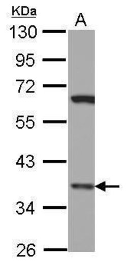 Invitrogen LHX8 Polyclonal Antibody 100 &mu;L | Buy Online | Invitrogen&trade; | Fisher Scientific