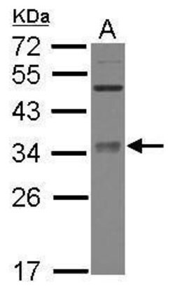 Invitrogen METTL6 Polyclonal Antibody 100 &mu;L | Buy Online | Invitrogen&trade; | Fisher Scientific
