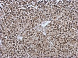 Invitrogen ORP9 Polyclonal Antibody 100 &mu;L; Unconjugated:Antibodies,