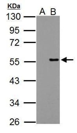 Invitrogen PPP4R2 Polyclonal Antibody 100 &mu;L; Unconjugated:Antibodies,
