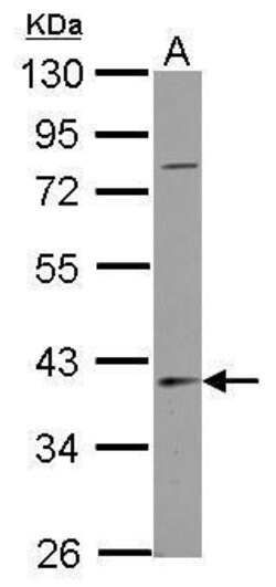 SERPINB7 Polyclonal Antibody, Invitrogen 100 &mu;L; Unconjugated:Antibodies,