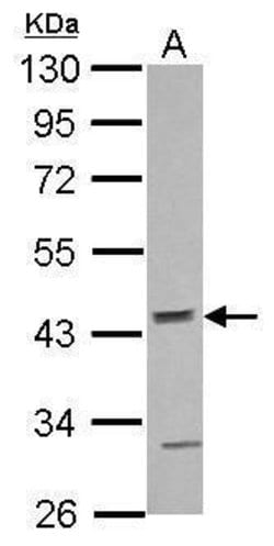 Invitrogen ACTR10 Polyclonal Antibody 100 &mu;L; Unconjugated:Antibodies,