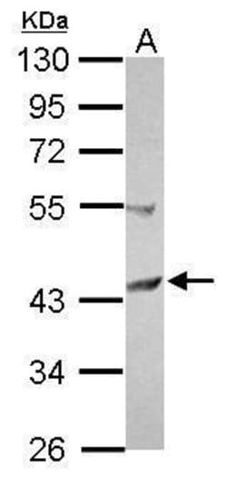 Invitrogen SCCPDH Polyclonal Antibody 100 &mu;L; Unconjugated:Antibodies,