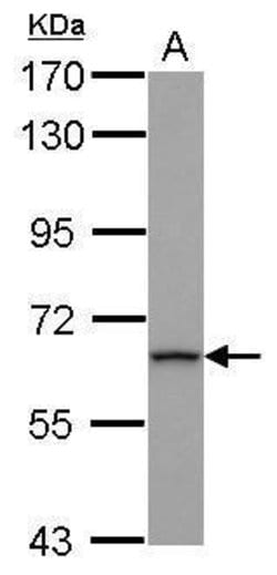Invitrogen ZNF416 Polyclonal Antibody 100 &mu;L | Buy Online | Invitrogen&trade; | Fisher Scientific