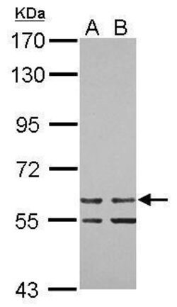 Invitrogen ZNF419 Polyclonal Antibody 100 &mu;L; Unconjugated:Antibodies,