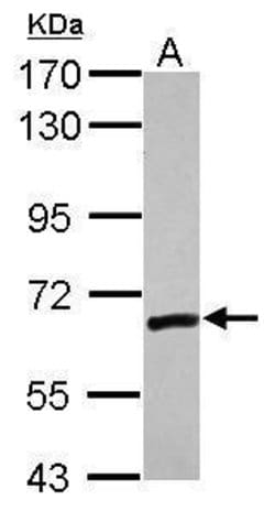 Invitrogen ZNF419 Polyclonal Antibody 100 &mu;L; Unconjugated:Antibodies,