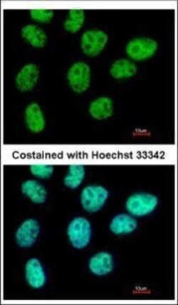 Invitrogen ZNF503 Polyclonal Antibody 100 &mu;L | Buy Online | Invitrogen&trade; | Fisher Scientific