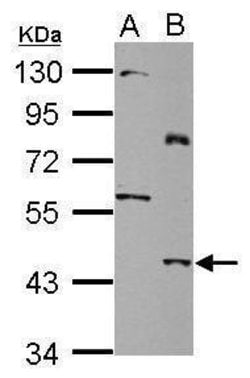 Invitrogen SLC25A46 Polyclonal Antibody 100 &mu;L; Unconjugated:Antibodies,