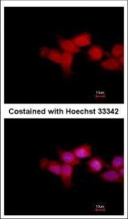 Invitrogen OTUD6B Polyclonal Antibody 100 &mu;L | Buy Online | Invitrogen&trade; | Fisher Scientific