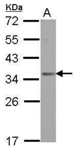 Invitrogen OTUD6B Polyclonal Antibody 100 &mu;L | Buy Online | Invitrogen&trade; | Fisher Scientific