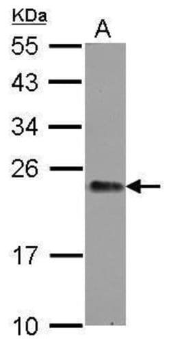 Invitrogen GNPNAT1 Polyclonal Antibody 100 &mu;L; Unconjugated:Antibodies,