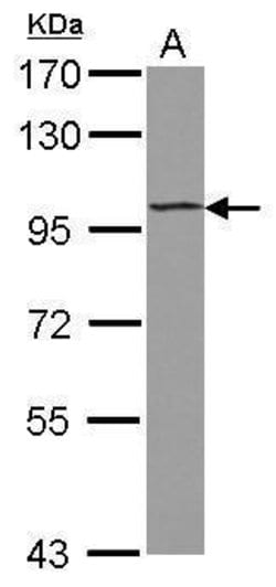 Invitrogen ST18 Polyclonal Antibody 100 &mu;L; Unconjugated:Antibodies,